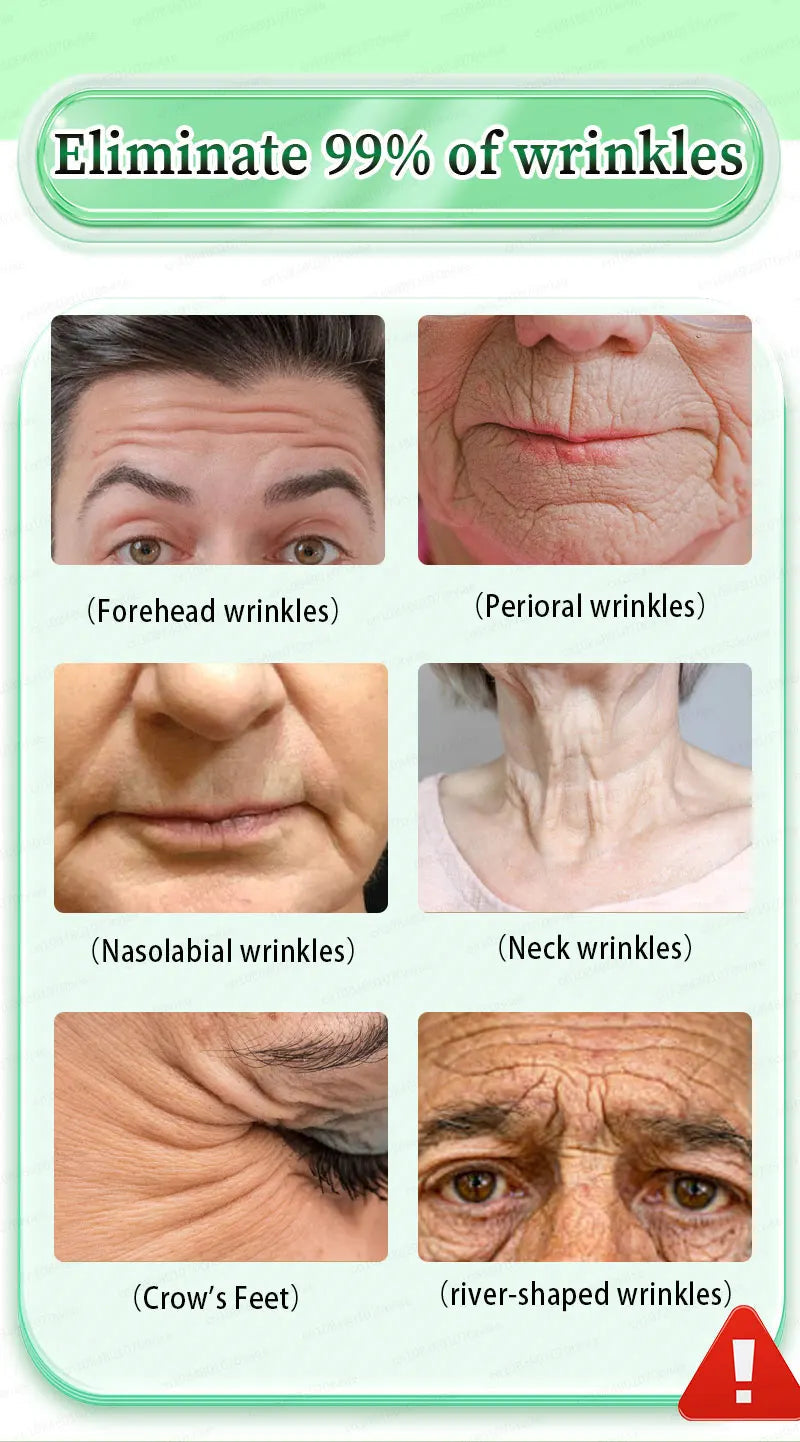 Wrinkles disappear, the first choice for beauty lovers Viralgem Store