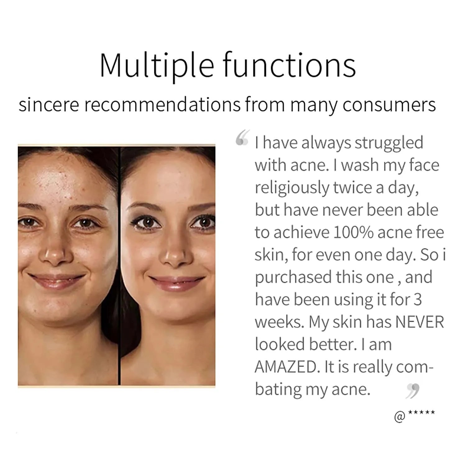 100g  Original Turmeric Soap For Dark Spot Skin Whitening Facial Body Hand Make Soap Bar Deep Cleaning Ginger Moisturizing Viralgem Store