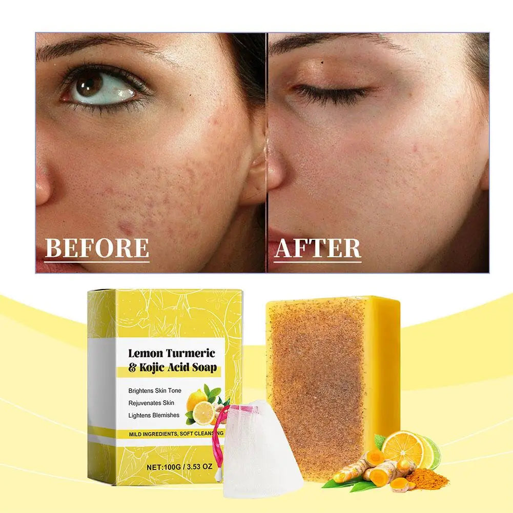 100g Lemon Turmeric Kojic Acid Soap Turmeric Face And Body Wash Clean Soap Bar, Firm Pores Lemon Turmeric Glowing Skin Care Soap