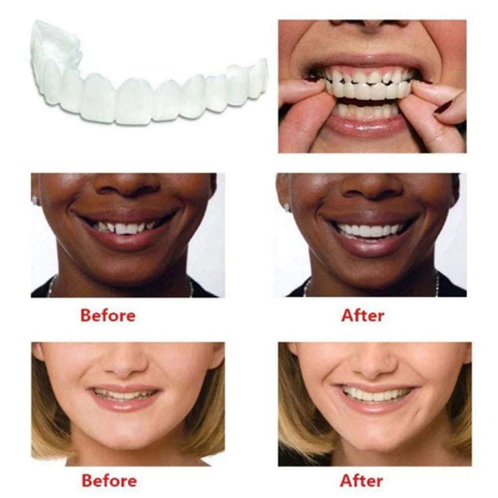 1-5Set Upper Lower Temporary Fit Fake Teeth Cosmetic Denture Smile Veneers False Teeth Brace Cover Upper False Tooth Cover Snap Viralgem Store