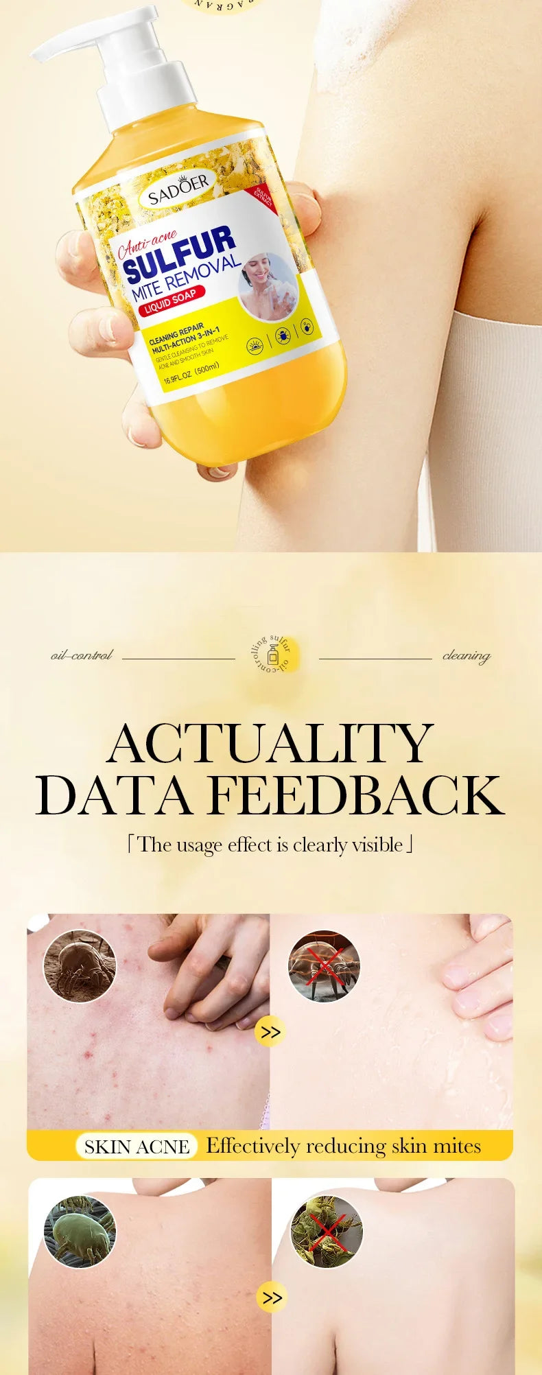 500ml Deep Cleansing Sulfur Mite Removal Body Wash Oil Control Shower Gel  Bath and Body Cleansers