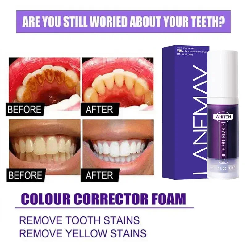 V34 Purple Teeth Whitening Toothpaste Remove Plaque Stains Cleaning Oral Hygiene Dental Bleach Tools Fresh Breath Beauty Health