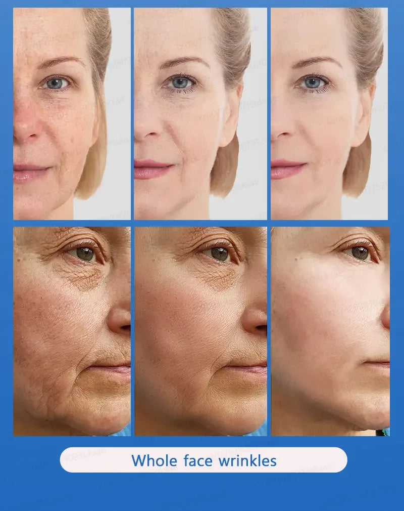 wrinkles disappear become beautiful now Viralgem Store