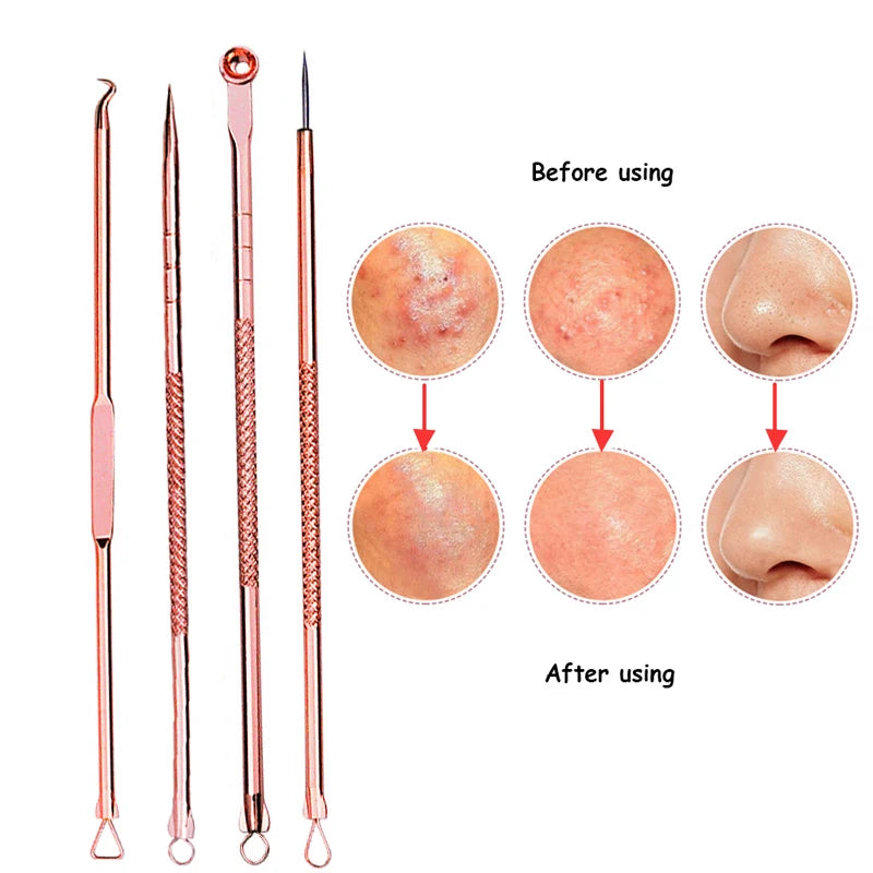 4Pcs Blackhead Removal Needles Black Dots Cleaner Stainless Spot Comedone Extractor Acne Treatment Needle Face Clean Care Tool Viralgem Store