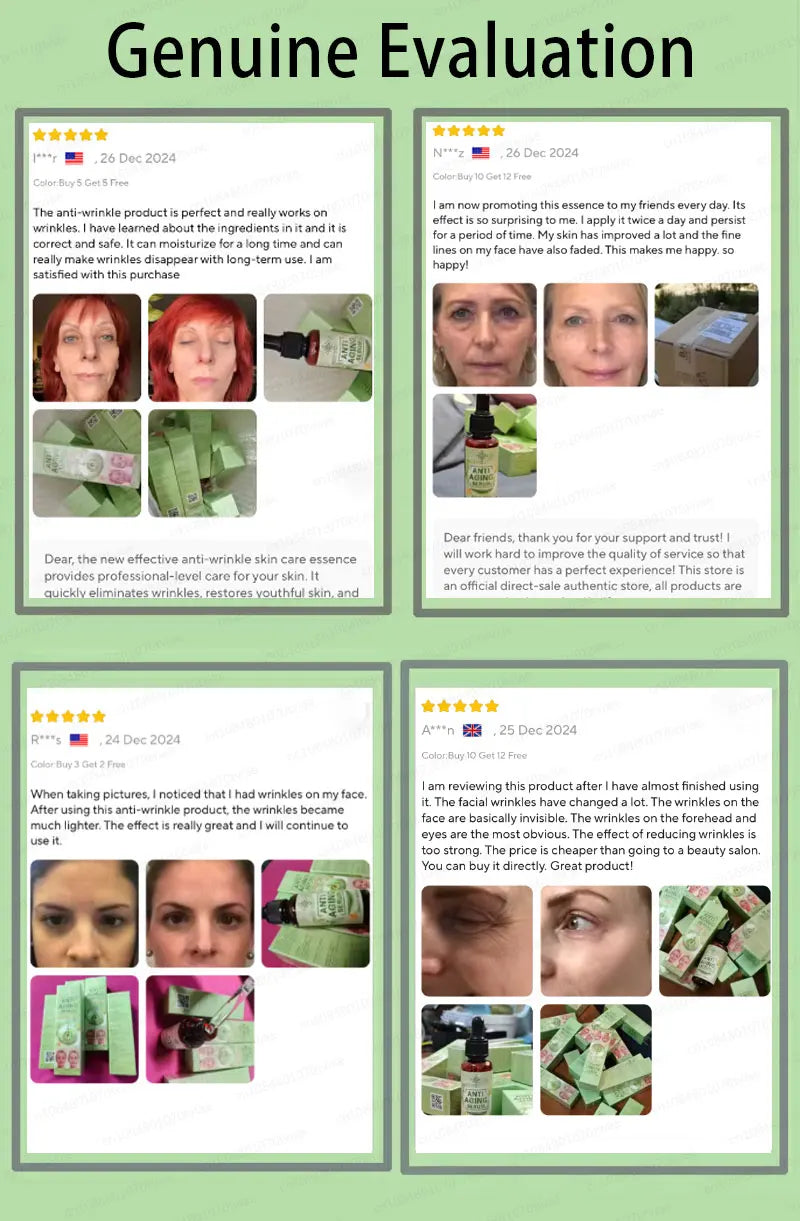 Wrinkles disappear, the first choice for beauty lovers Viralgem Store