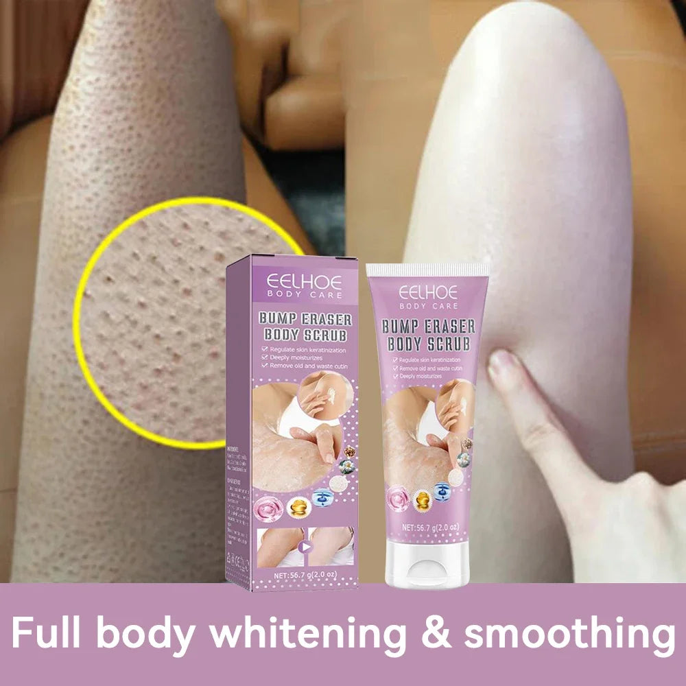7-Day Fast Body Scrub Cream Moisturizing Skin Repair Keratosis Pilaris Removing Strawberry Legs Eraser Nourishing Body Skin Care Viralgem Store