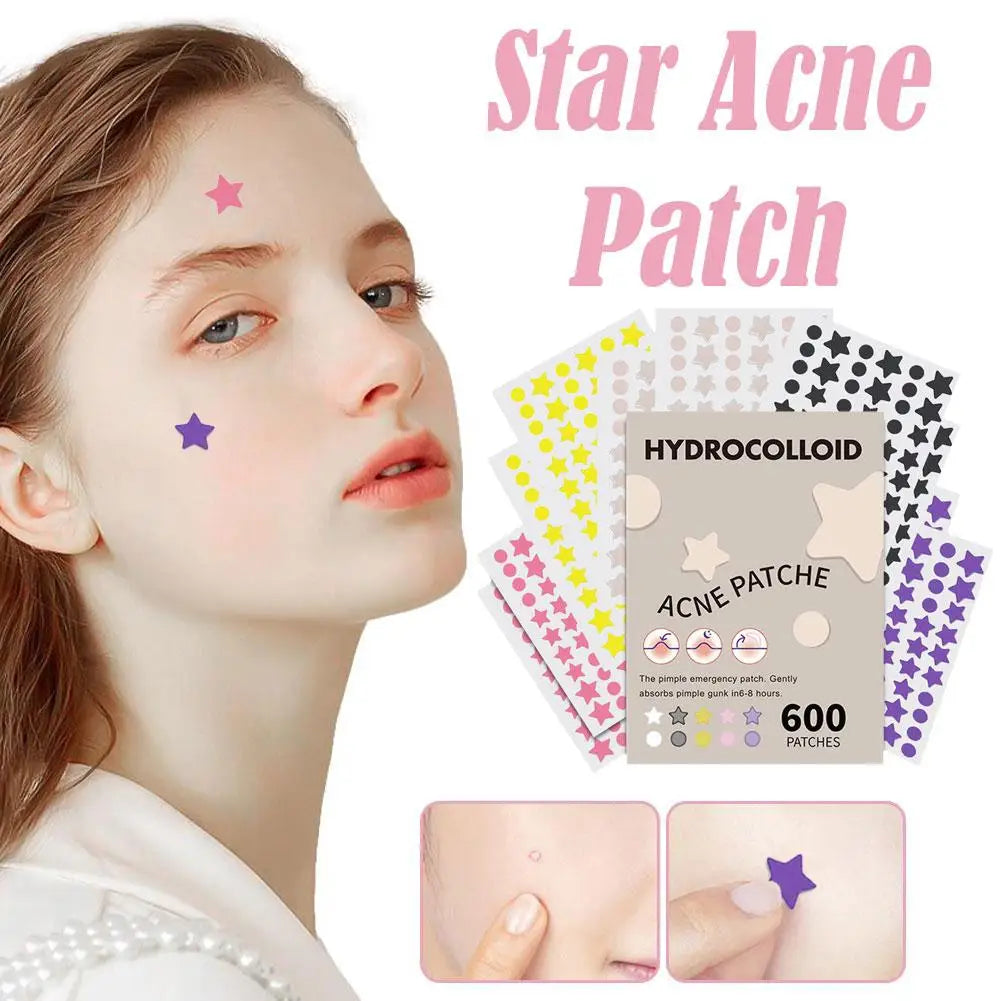 600pcs Large Size Star Acne Patch Mild Non-irritating Lightens Acne Hydrocolloid Acne Sticker For Blackheads Closed Comedones