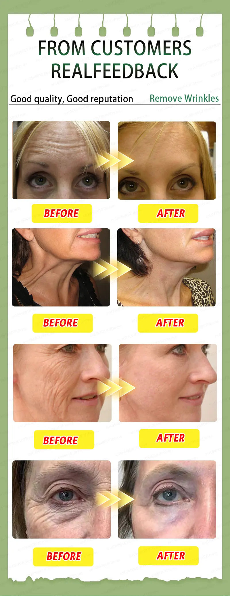 Wrinkles disappear, the first choice for beauty lovers Viralgem Store