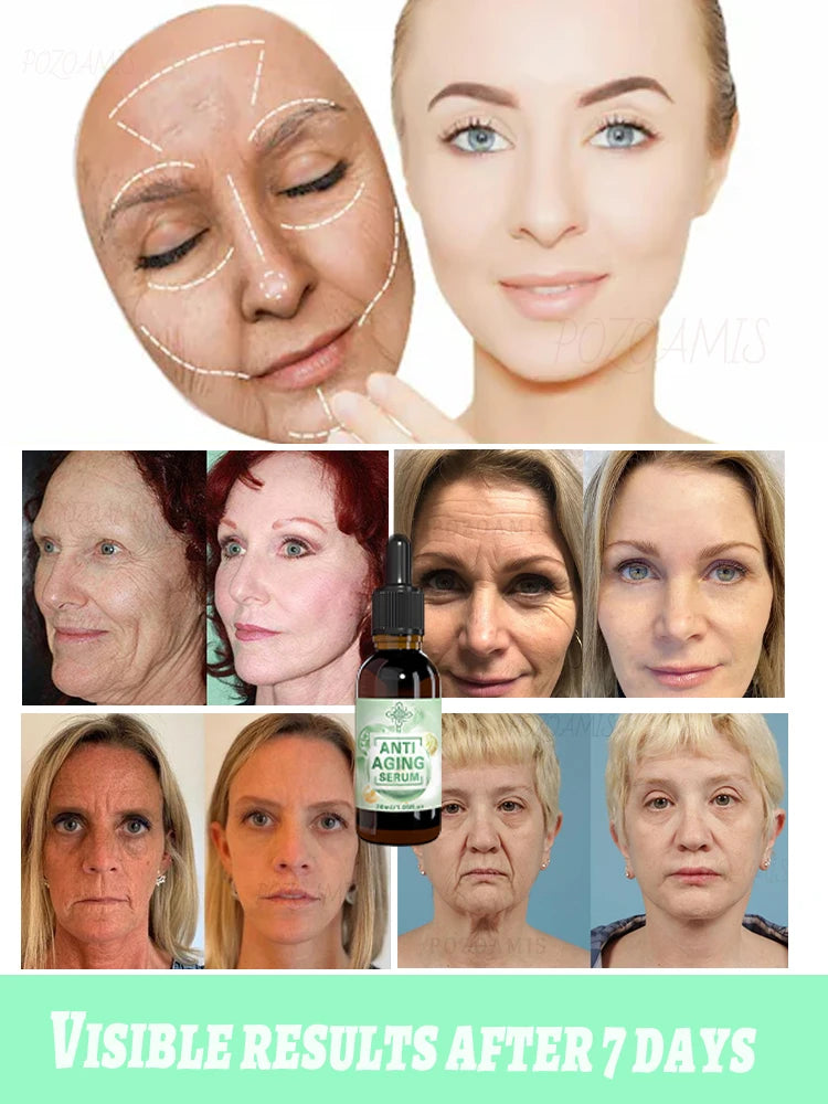 Wrinkles disappear, the first choice for beauty lovers Viralgem Store