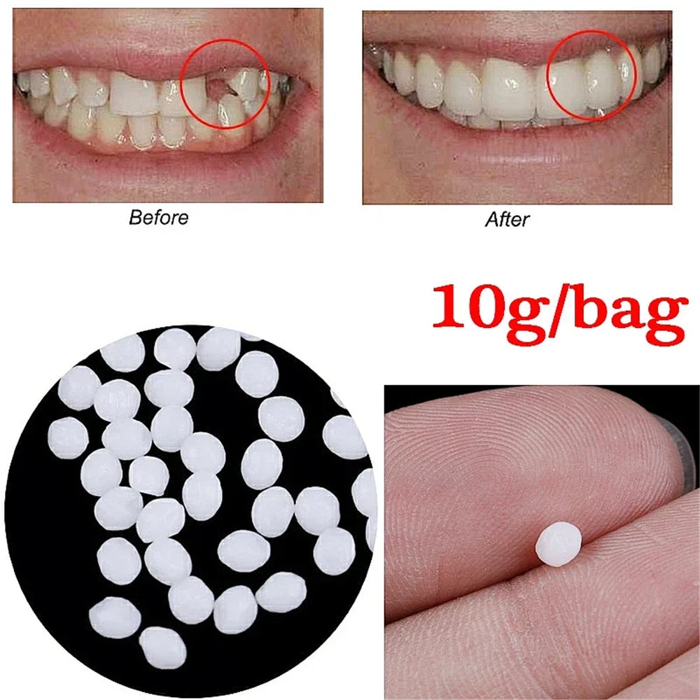 50g Resin Temporary Tooth Repair Granules Teeth Gaps Missing Broken Tooth Filling Moldable Adhesive Dentures False Teeth Tools Viralgem Store