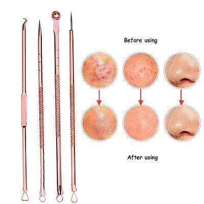4Pcs Blackhead Removal Needles Black Dots Cleaner Stainless Spot Comedone Extractor Acne Treatment Needle Face Clean Care Tool Viralgem Store
