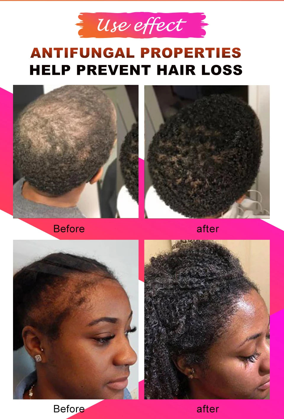 10ml Chebe Spray Fast Hair Growth Oil Hair Loss Treatment Traction Alopecia Spray Repair Damage Anti Hair Break Hair Care Spray