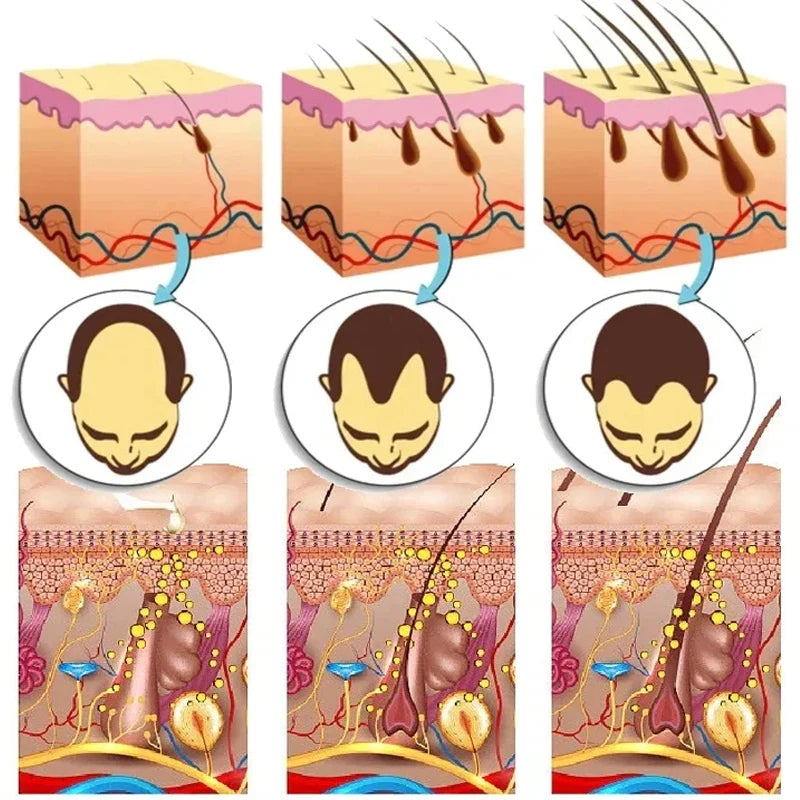 7 Days Ginger Hair Growth Serum Fast Promote Hair Regrowth Products Anti Hair Loss Repair Scalp Baldness Nourish Hair Root Care Viralgem Store