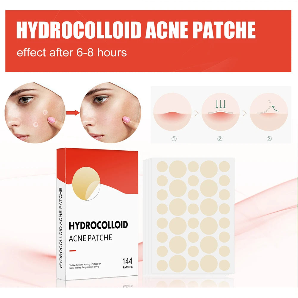 144pcs/set Face Skin Care Acne Pimple Patch 2 Sizes Invisible Professional Healing Absorbing Spot Sticker Covering for Men Women Viralgem Store