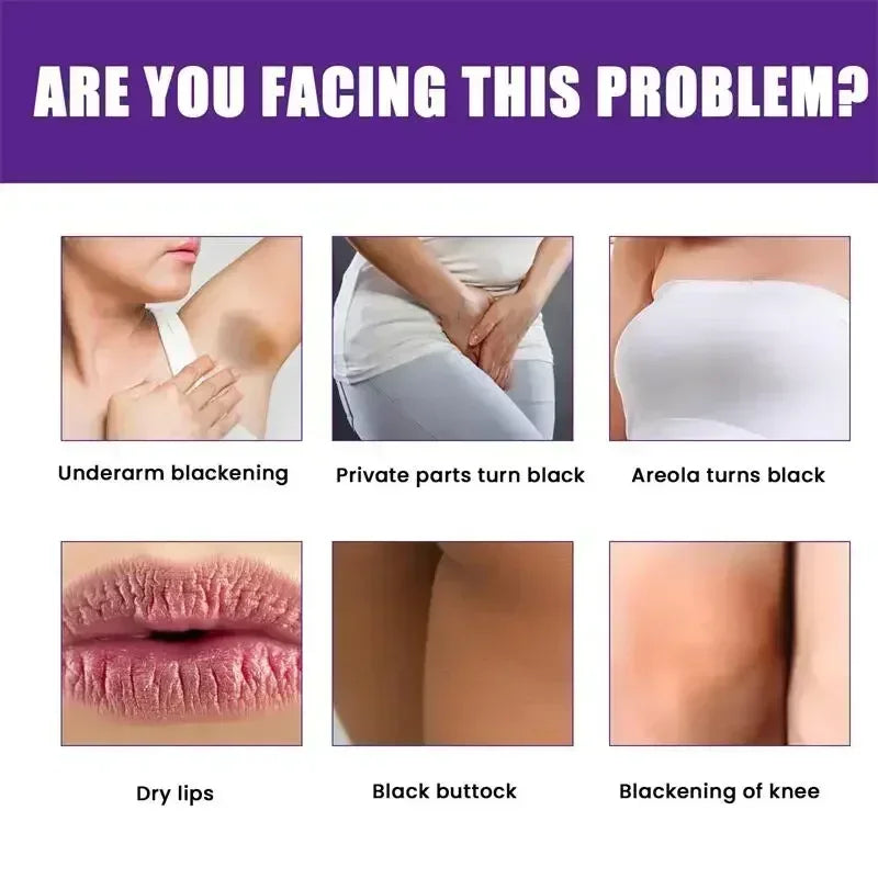 2025Dark knuckles whitening serum Elbows Armpit Beaching Serum Private parts whitening essence Lightens Elbows Knees Underarms Viralgem Store