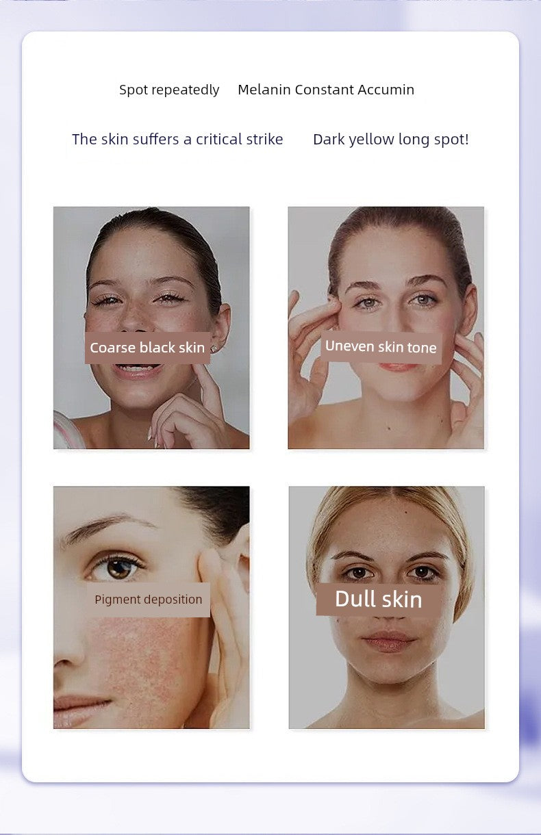 377 Whitening and Freckle Removing Essence Oil Nicotinamide VC Anti-Oxidation Anti-Yellow Brightening Cream Official Flagship Store