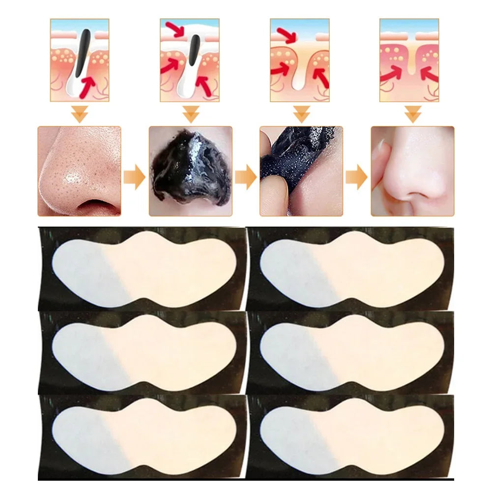 10PCS Nose Blackhead Remover Mask Deep Cleansing Skin Care Shrink Pore Acne Treatment Mask Nose Black Dots Pore Clean Strips Viralgem Store
