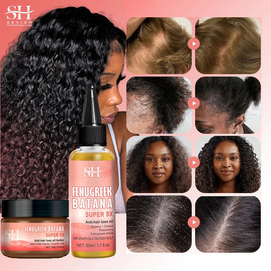 Super 5x Fenugreek Anti-Hair Loss Oil For Man Hair Treatment Fast Regrowth Thicken Oils Scalp Damaged  Repair Care Products Viralgem Store