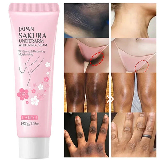 Whitening Cream For Dark Skin Armpit Thigh Inner Joint Lightening Intimate Area Underarm Body Care Private Parts Brighten Lotion Viralgem Store