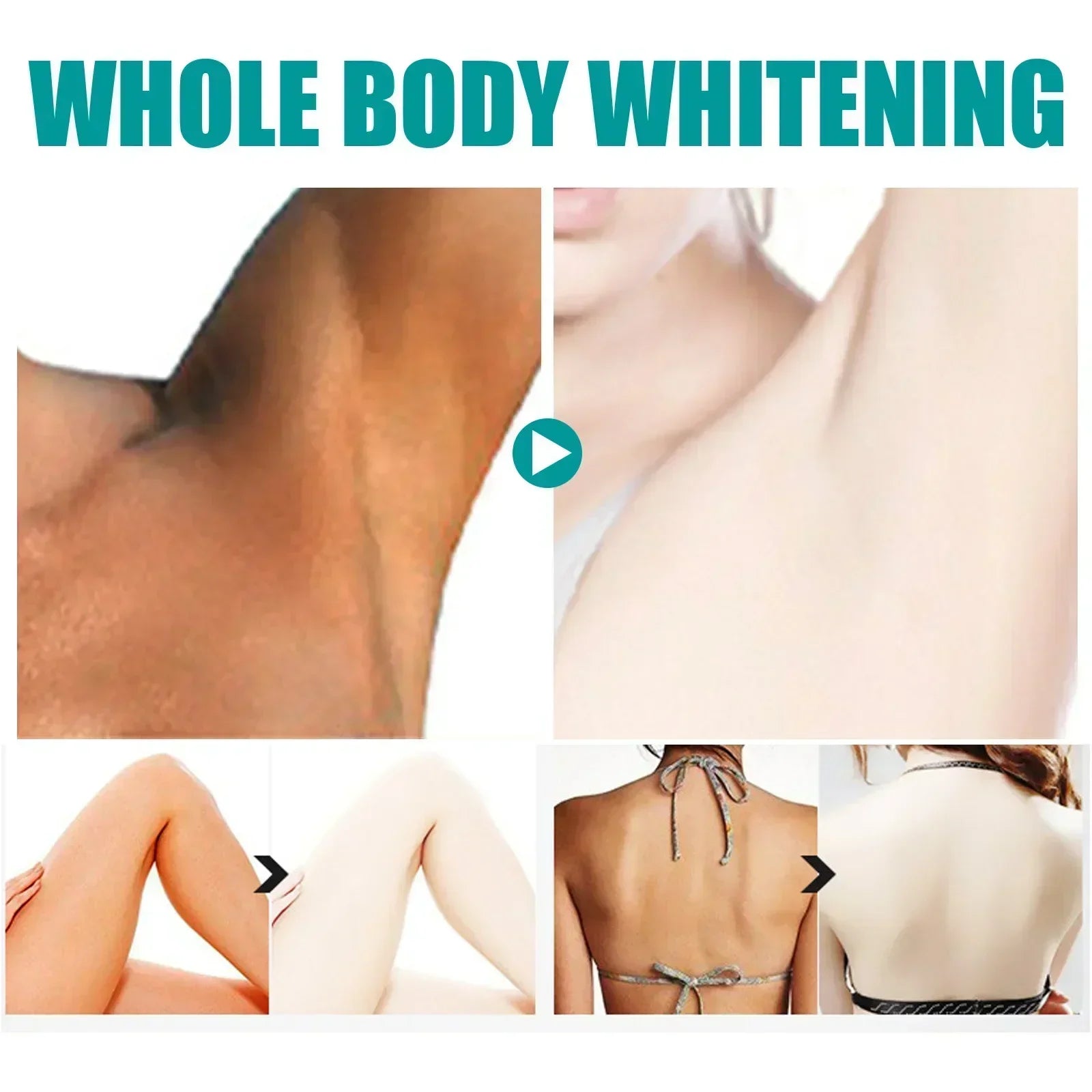2025Dark knuckles whitening serum Elbows Armpit Beaching Serum Private parts whitening essence Lightens Elbows Knees Underarms Viralgem Store