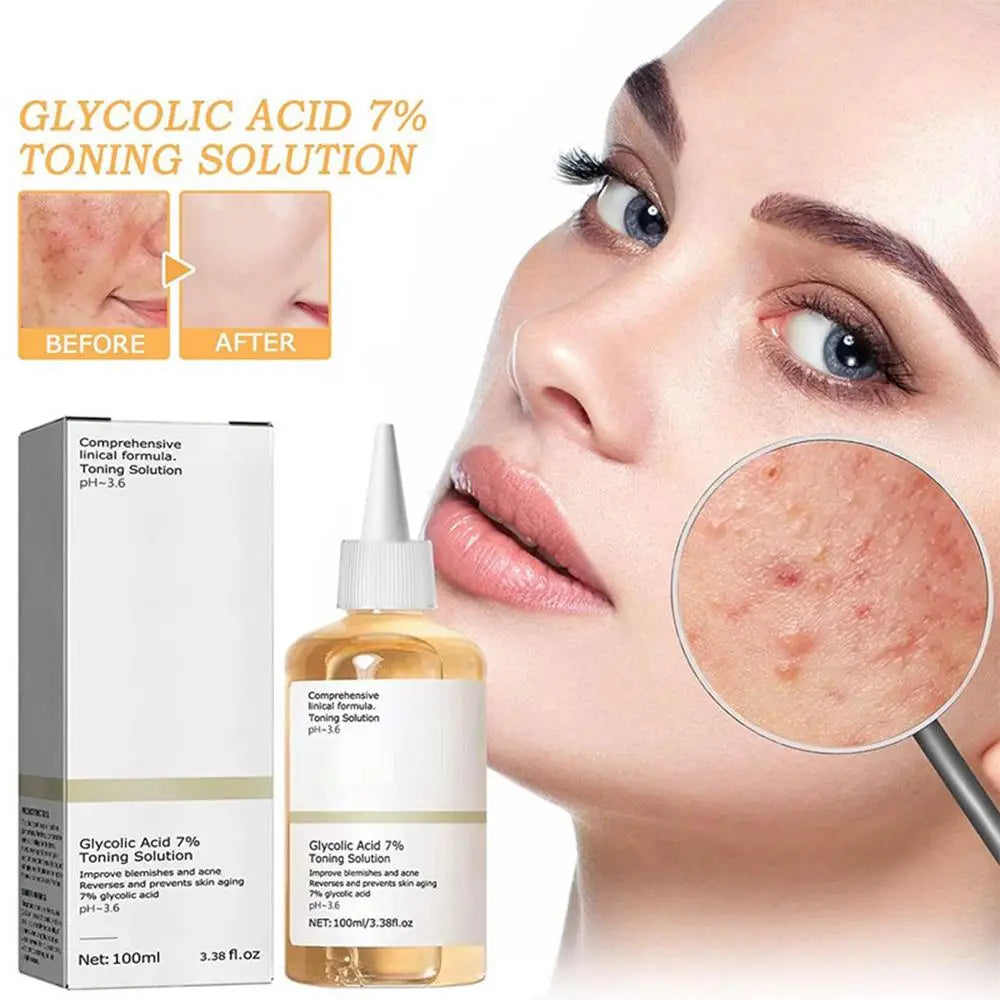 100ml Glycolic Acid 7% Toner,Fruit Acid Toner 7% Glycolic Acid Toner, Whitening Acne Printing Moisturizing Exfoliating Essence
