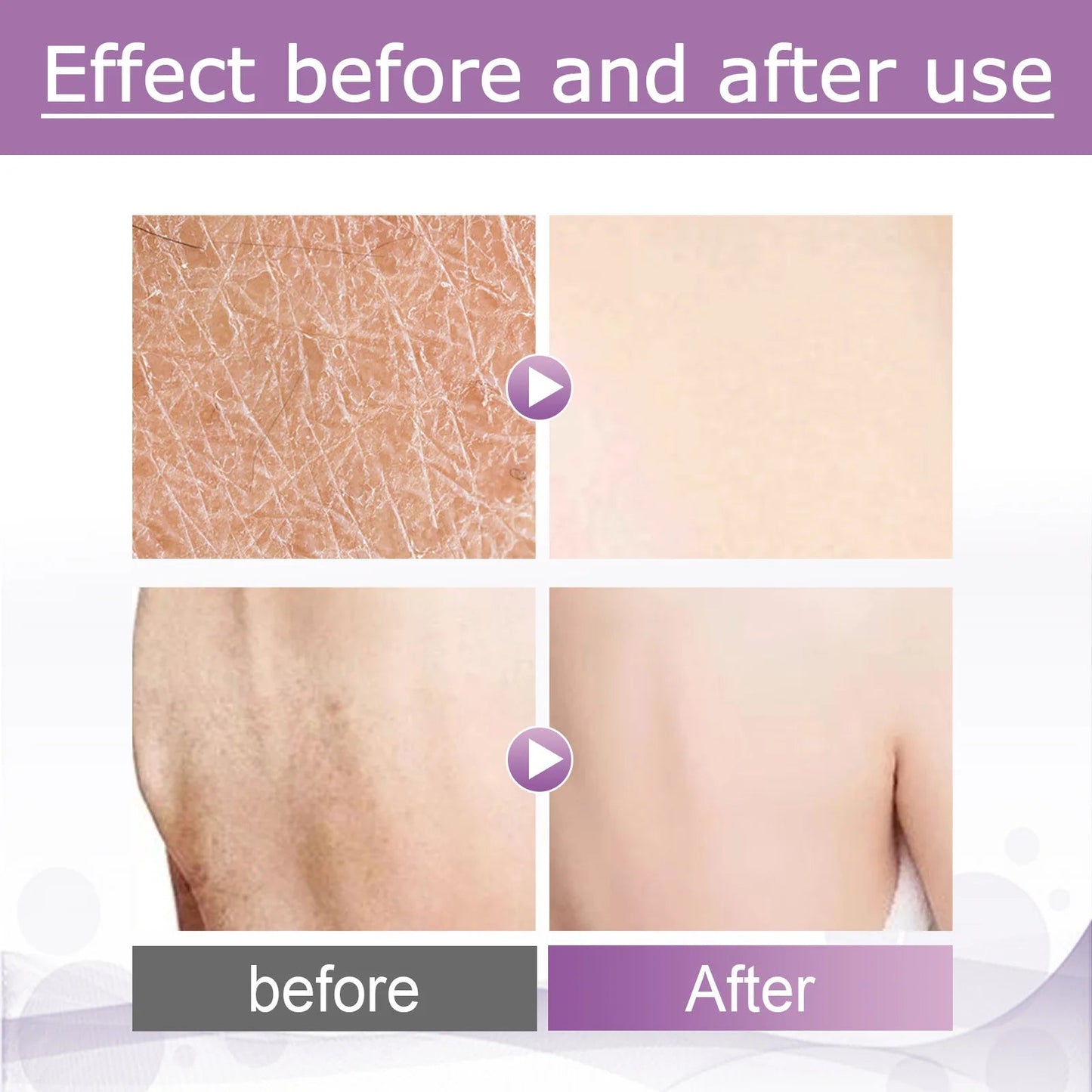 7-Day Fast Body Scrub Cream Moisturizing Skin Repair Keratosis Pilaris Removing Strawberry Legs Eraser Nourishing Body Skin Care Viralgem Store