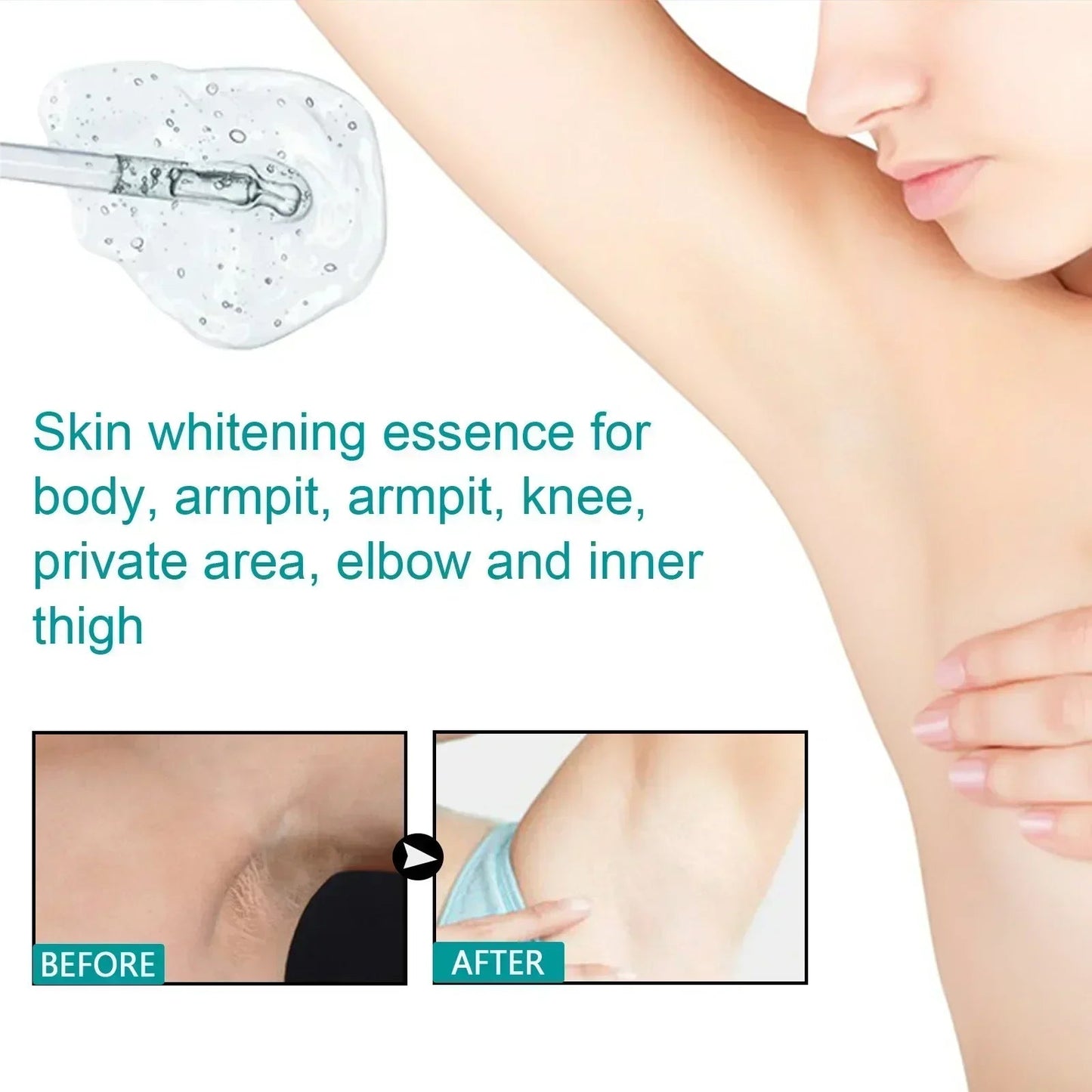 2025Dark knuckles whitening serum Elbows Armpit Beaching Serum Private parts whitening essence Lightens Elbows Knees Underarms Viralgem Store