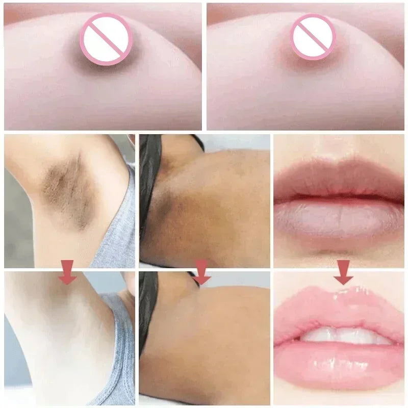 2025Dark knuckles whitening serum Elbows Armpit Beaching Serum Private parts whitening essence Lightens Elbows Knees Underarms Viralgem Store