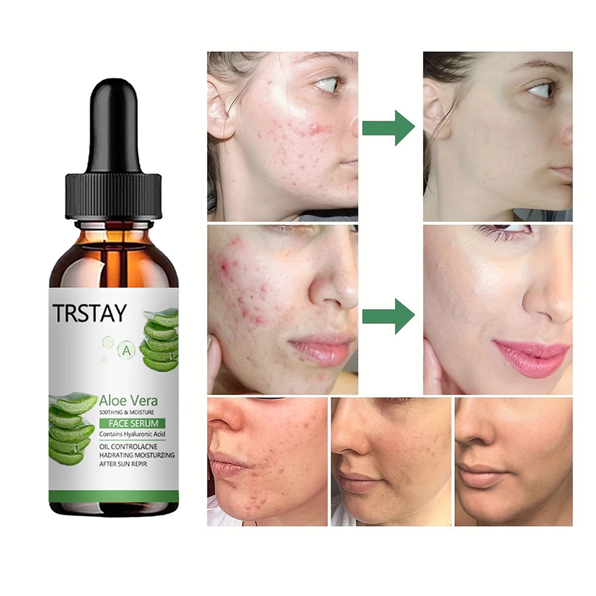 44466693669020|44466693701788|44466693734556|44466693767324