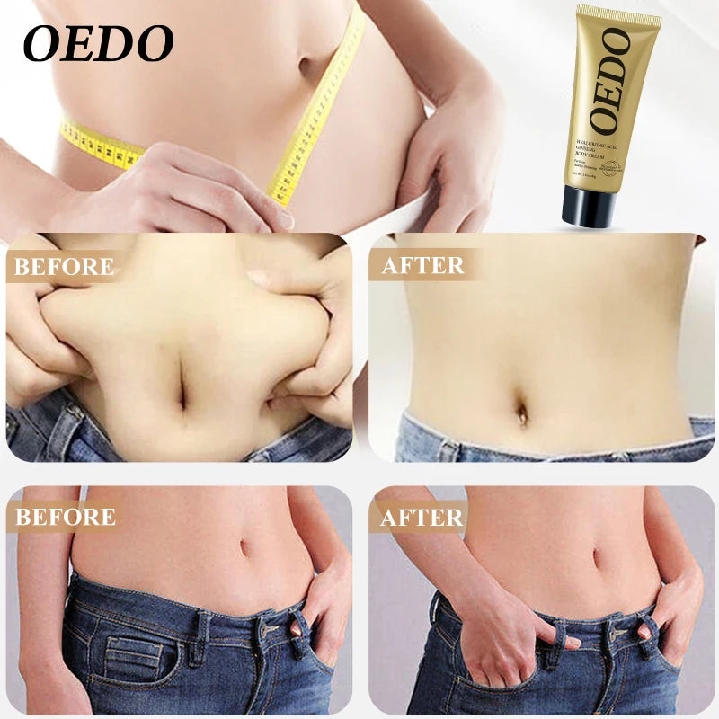 【Local Shipping】 Hyaluronic Acid Ginseng Anti Cellulite Shaping Create Body Shaping Cream Fat Burning Belly Skin Tighten Cream Viralgem Store