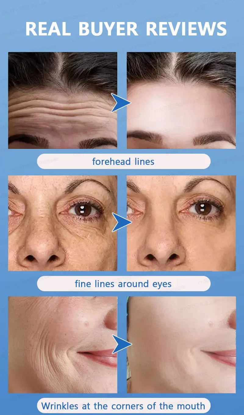 wrinkles disappear become beautiful now Viralgem Store