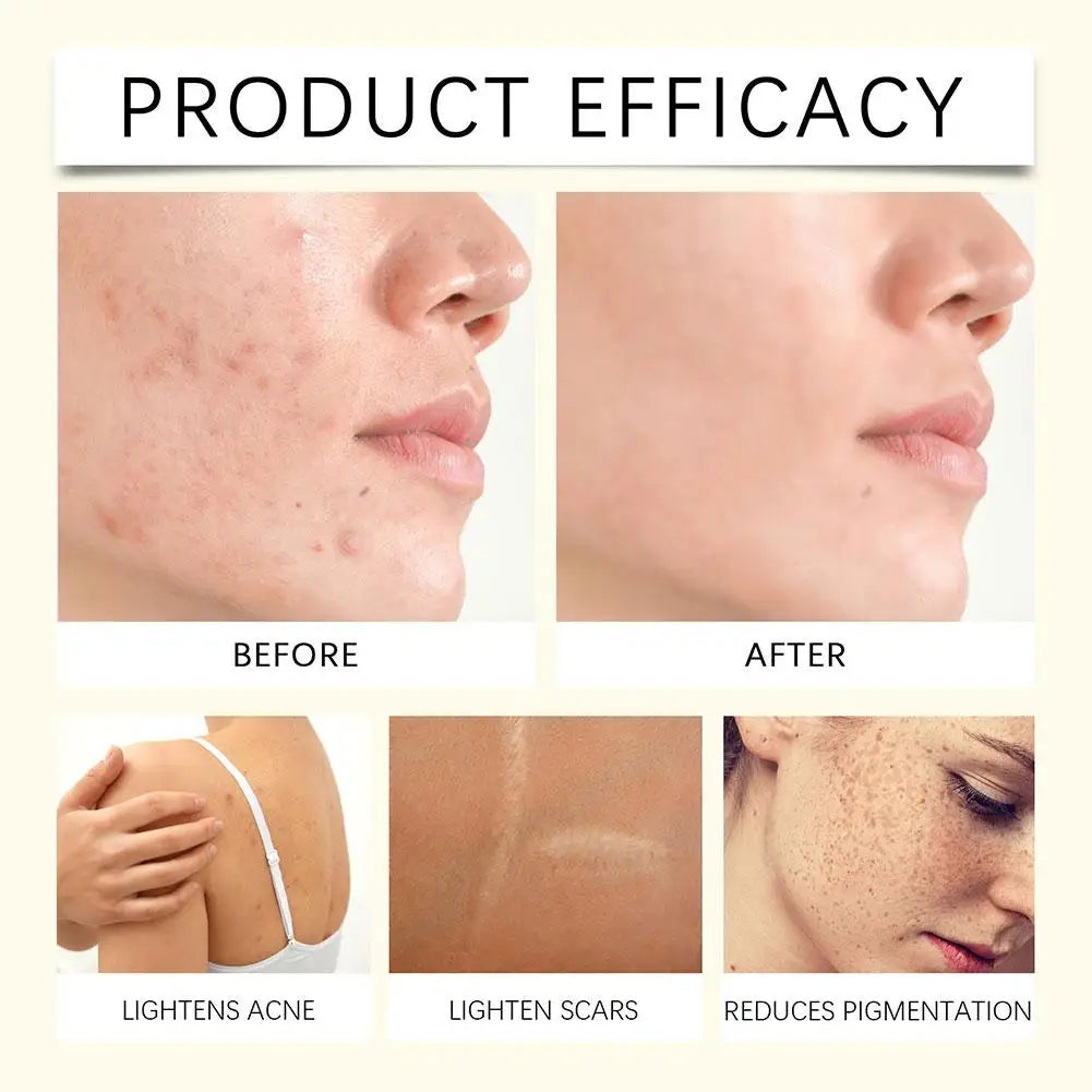 100g Lemon Turmeric Kojic Acid Soap Turmeric Face And Body Wash Clean Soap Bar, Firm Pores Lemon Turmeric Glowing Skin Care Soap