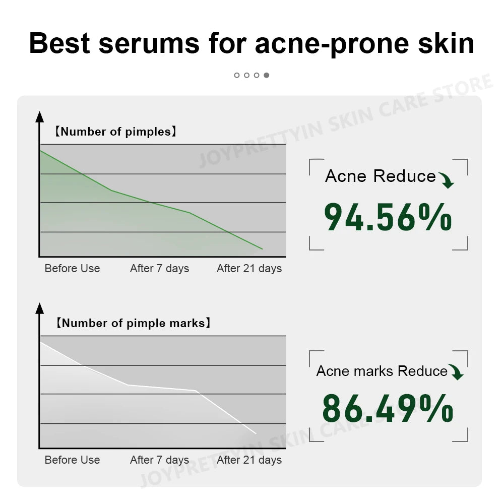 Tea Tree Acne Treatment Facial Serum Moisturizing Hyaluronic Acid Oil Control Pimple Removal Essence Face Serum Skin Care