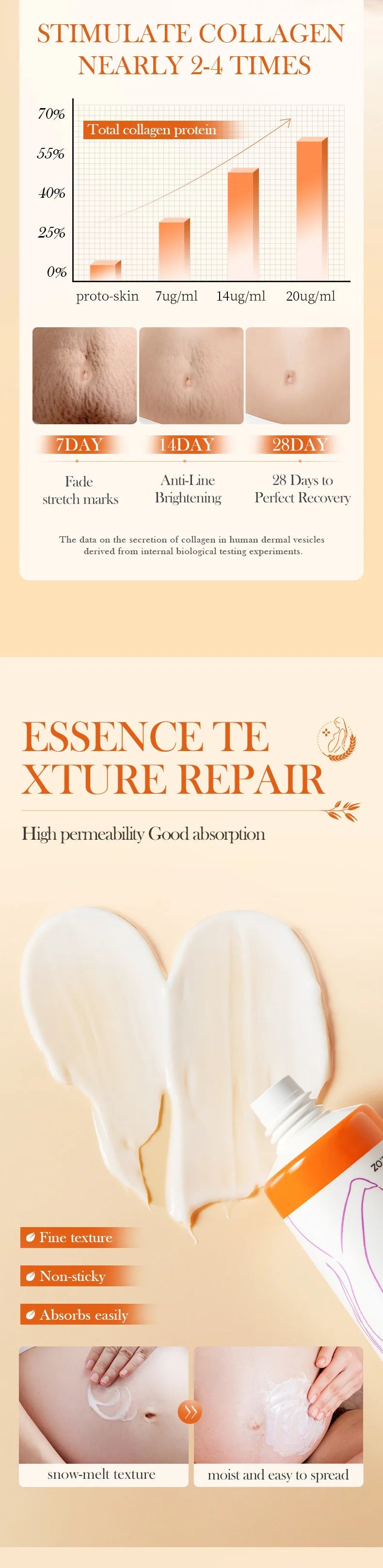 Stretch Marks Permanent Removal Cream Eliminate Body Belly Stretch Marks Swelling Marks Remove Skin Cracks Repair Firming Care Viralgem Store