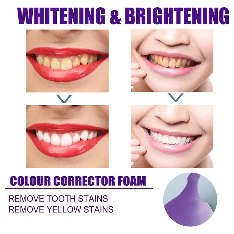 50ml V34 Mousse Toothpaste Teeth Whitening Removing Yellow Teeth Cleaning Tooth Stain Oral Fresh Tooth Care Product 2024 New