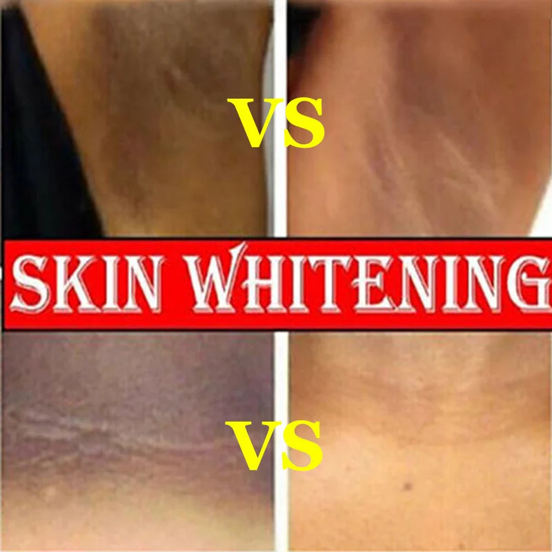 Whitening Cream Private Parts Underarm Bleaching Serum Whiten Butt Knee Brighten Inner Thigh Intimate Parts Dark Remove Melanin Viralgem Store