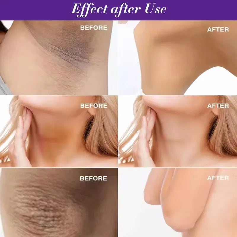 50g Body Underarm Whitening Cream Private Parts Bleaching Whiten Butt Knee Brighten Inner Thigh Intimate Dark Remove Melanin Viralgem Store