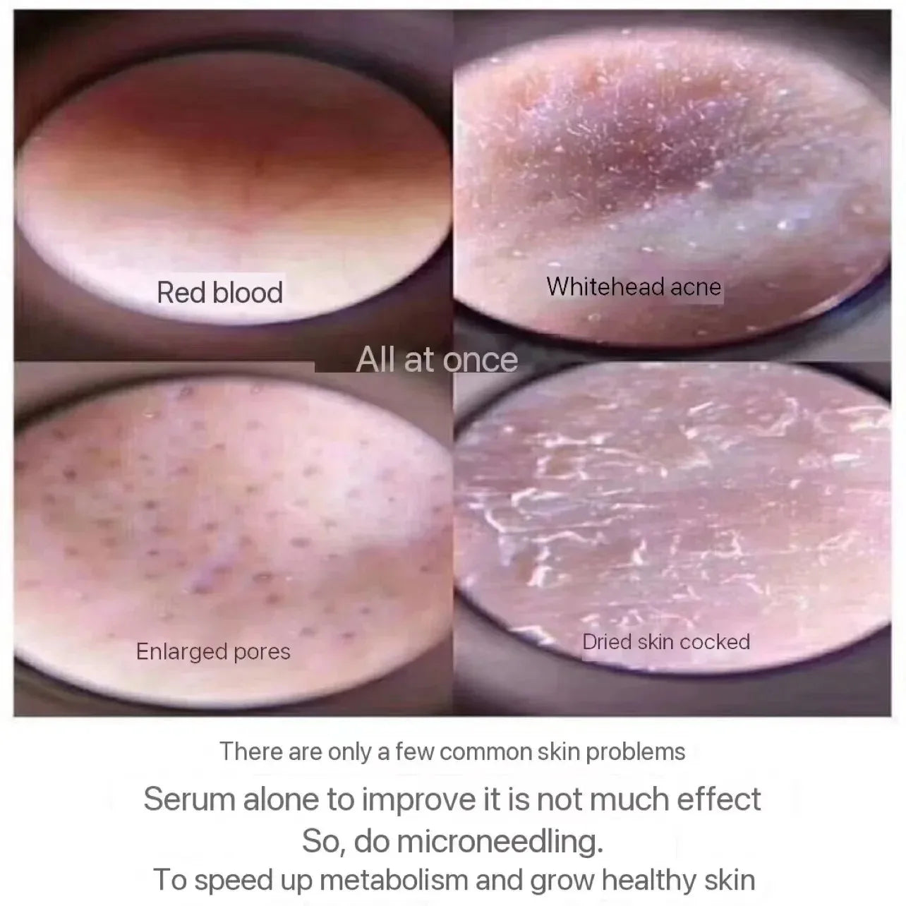 10pcs Sponge Microcrystal Freeze-dried Powder Collagen Regeneration Natural Biological Extract Sponge Spicules Skin Cell Renew Viralgem Store