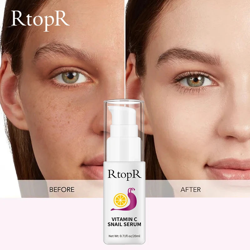 44466699796636|44466699829404|44466699862172|44466699894940