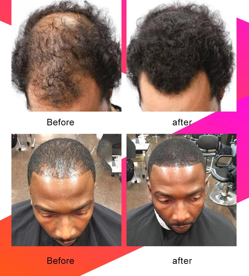 10ml Chebe Spray Fast Hair Growth Oil Hair Loss Treatment Traction Alopecia Spray Repair Damage Anti Hair Break Hair Care Spray