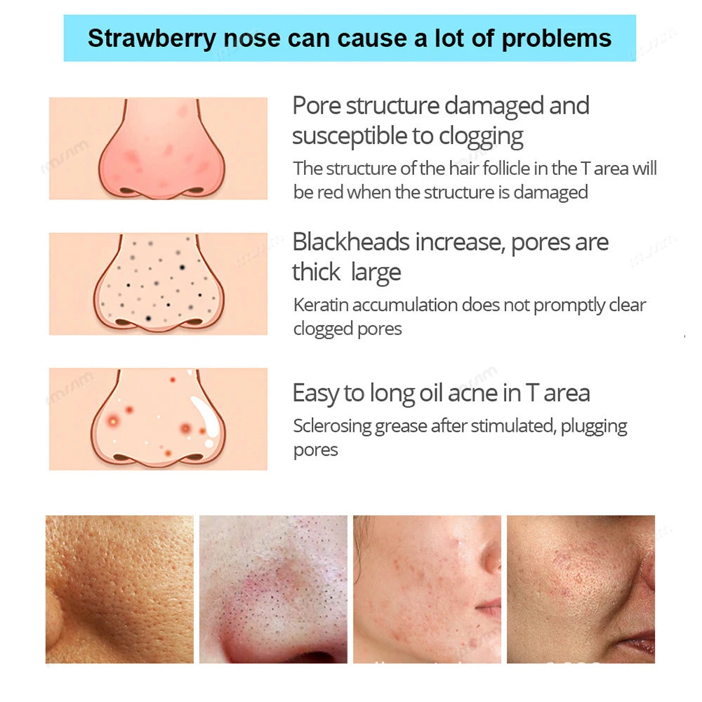 Unisex Deep Cleansing Nose Strips for Acne & Blackhead Removal Shrink Pore Nose Black Head Stickers Skin Care Patch