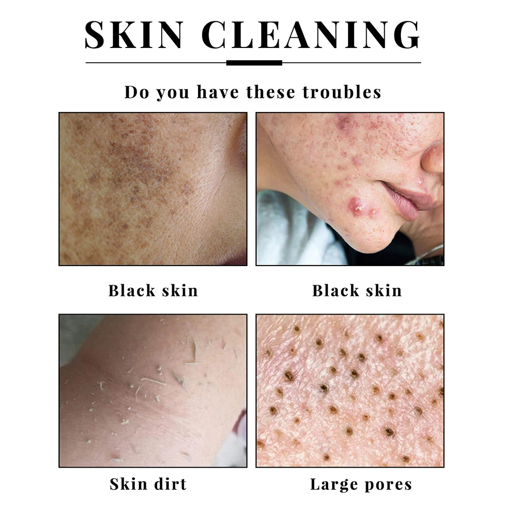 2Pcs Handmade Kojic Acid Soap Natural Mild Non-irritating Brightening Skin Exfoliator Body Face Cleansing Whitening Soap