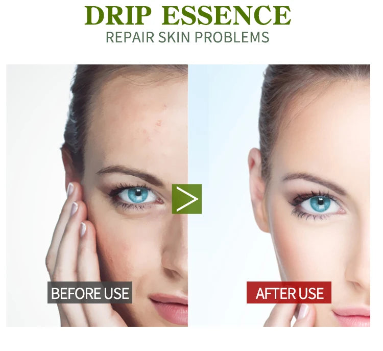 Vitamin B5 Face Serum Smooth Moisturizing Repair Dry Skin Aloe Soothe Pores Shrink Firming Hydrating Oil Control Facial Essence