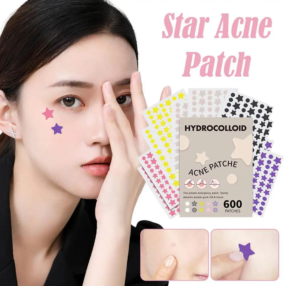 600pcs Large Size Star Acne Patch Mild Non-irritating Lightens Acne Hydrocolloid Acne Sticker For Blackheads Closed Comedones