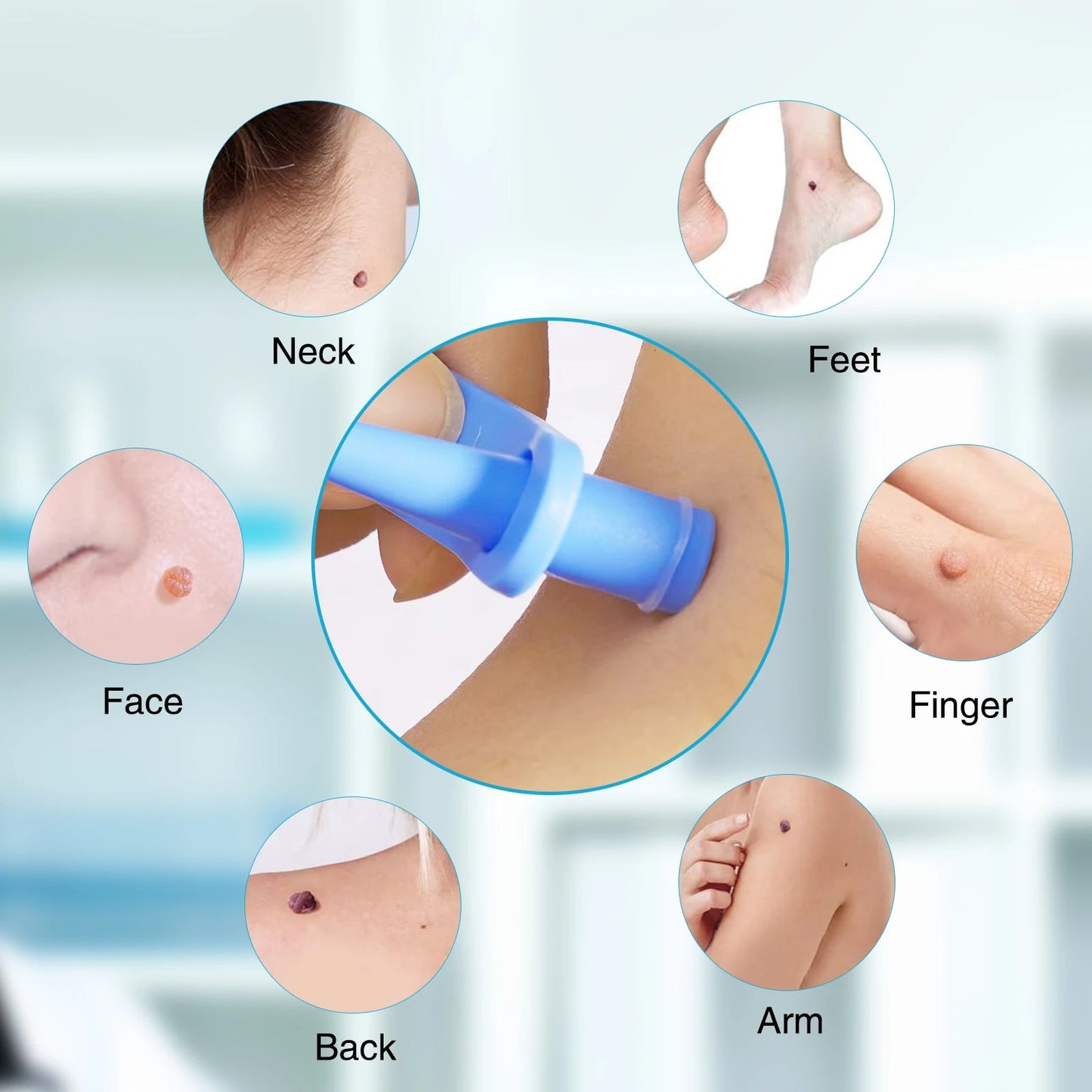 2 IN 1 Auto Micro Skin Tag Remover Device Standard And Micro Skin Tag Removal Kit Adult Mole Wart Remover Face Care Beauty Tools Viralgem Store