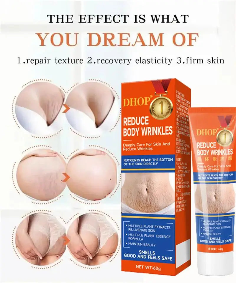 Stretch Marks Permanent Removal Cream Maternity Pregnant Women Pregnancy Anti-Winkle Smooth Repair Firming Skin Body Skin Care