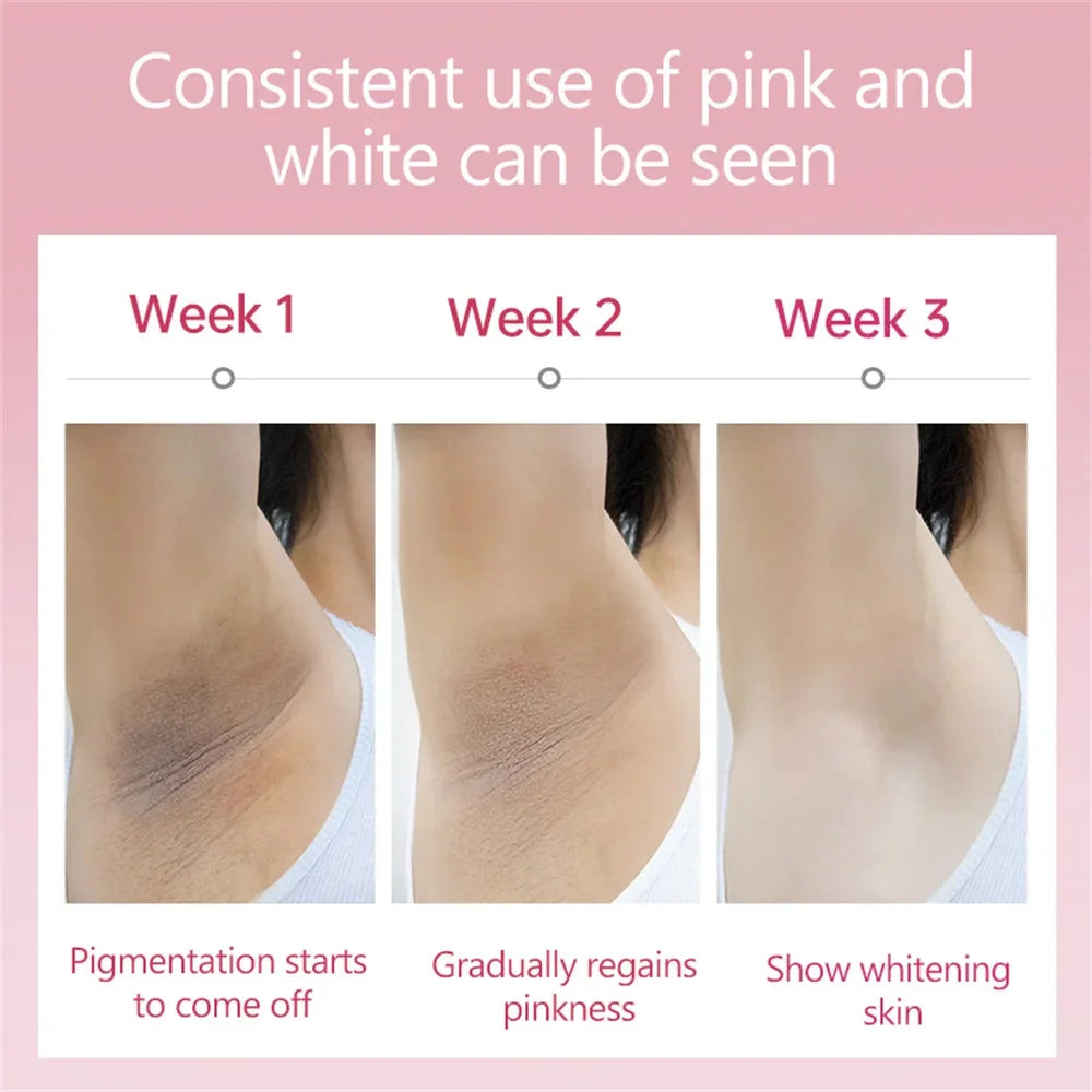 Whitening Cream For Dark Skin Armpit Thigh Inner Joint Lightening Intimate Area Underarm Body Care Private Parts Brighten Lotion Viralgem Store