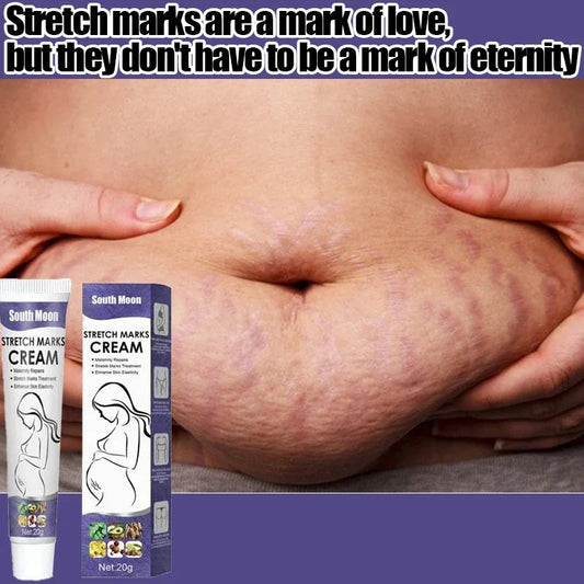 Stretch Mark Removal Cream Permanently Removes Stretch Marks Rejuvenates Skin Stretch Mark Removal Cream Viralgem Store