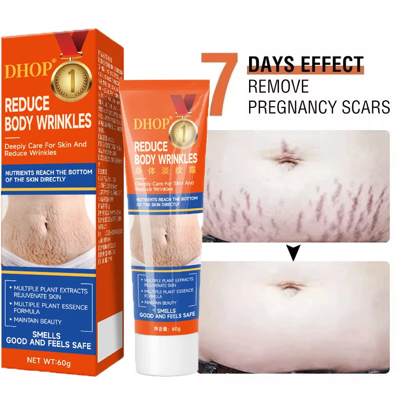 Stretch Marks Permanent Removal Cream Maternity Pregnant Women Pregnancy Anti-Winkle Smooth Repair Firming Skin Body Skin Care