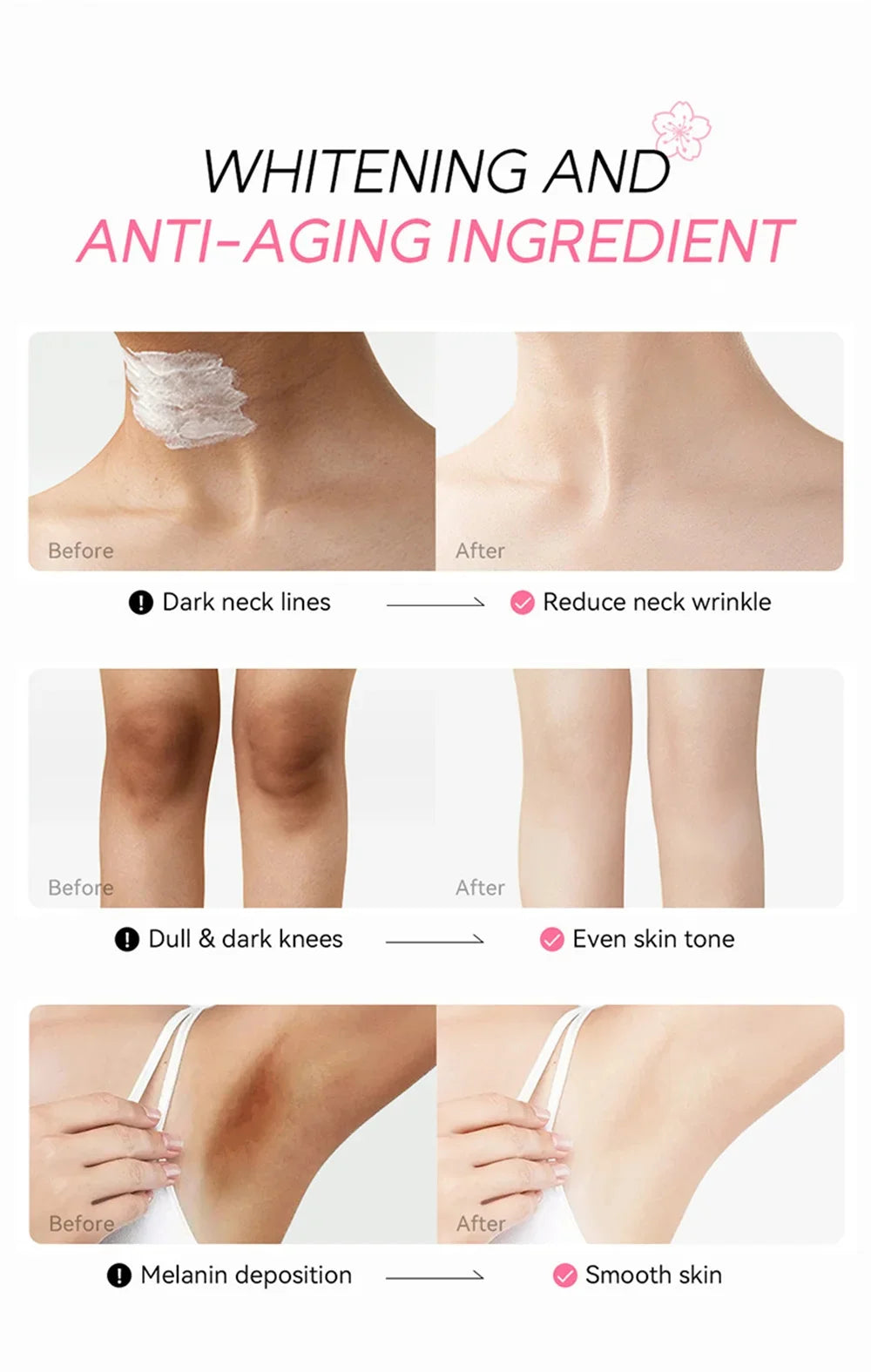 Whitening Cream For Dark Skin Armpit Thigh Inner Joint Lightening Intimate Area Underarm Body Care Private Parts Brighten Lotion Viralgem Store